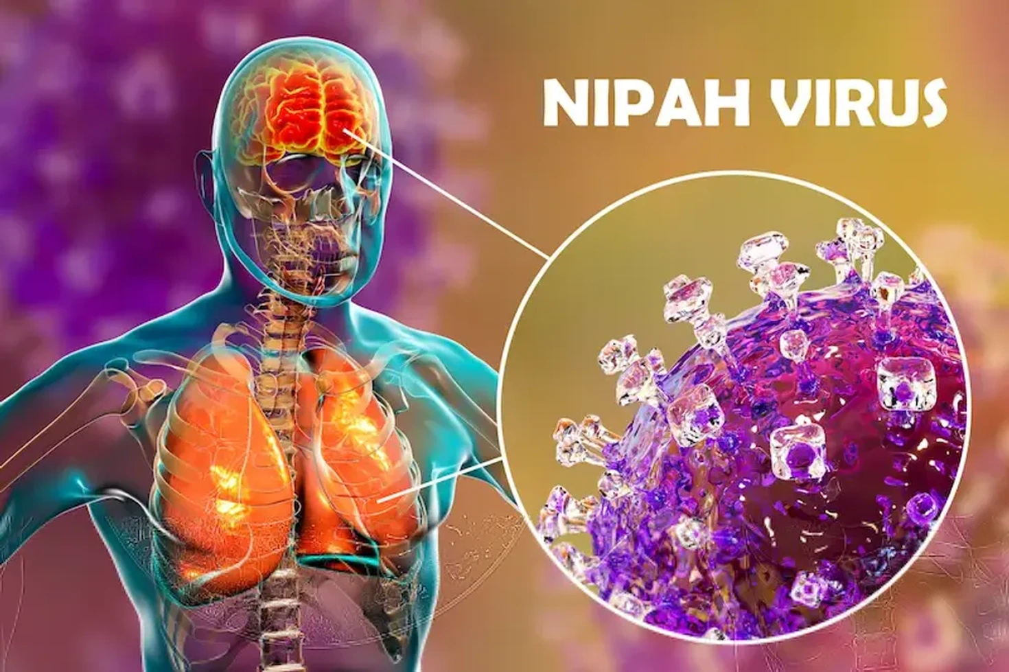 Người dân nên phòng chống viuss Nipah như thế nào khi chưa có vaccine